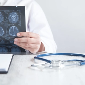 День невролога! Заботимся о здоровье нервной системы