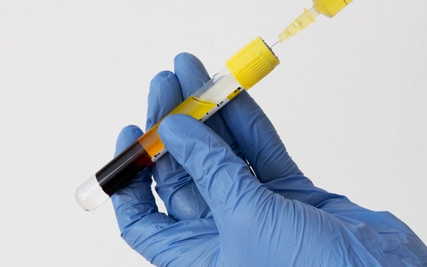 SVF-терапия суставов