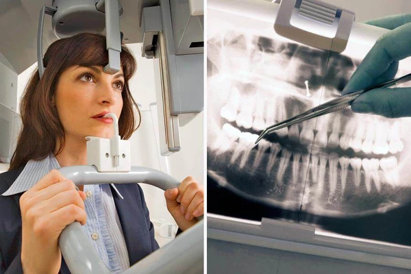 Ортопантомография - панорамная томография зубных рядов