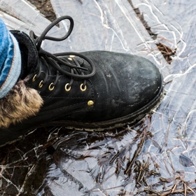 Сезон гололёда: с какими травмами обращаются пациенты
