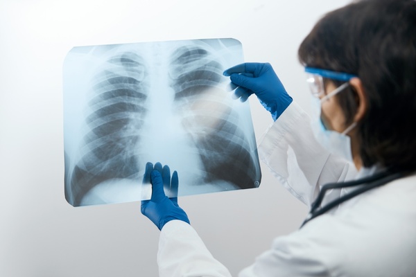 Фтизиатрия