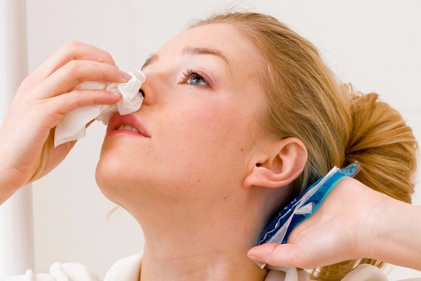 Могут ли частые носовые кровотечения означать серьёзное заболевание