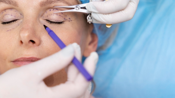 Блефаропластика - коррекция формы век