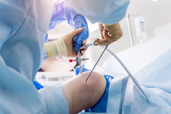 Артроскопия