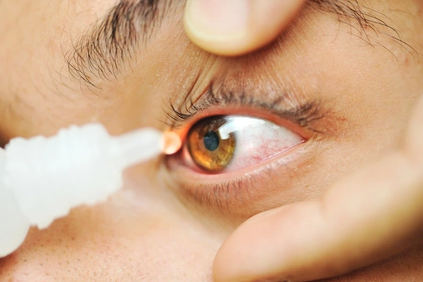 Синдром сухого глаза - причины, диагностика, лечение